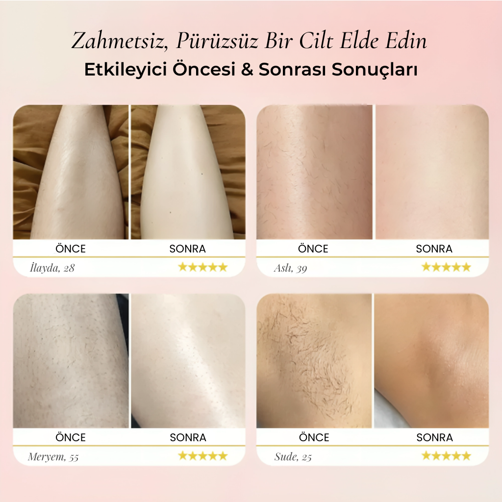 Rosélle® Bikini & Vücut Tıraş Cihazı