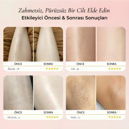 Rosélle® Bikini & Vücut Tıraş Cihazı